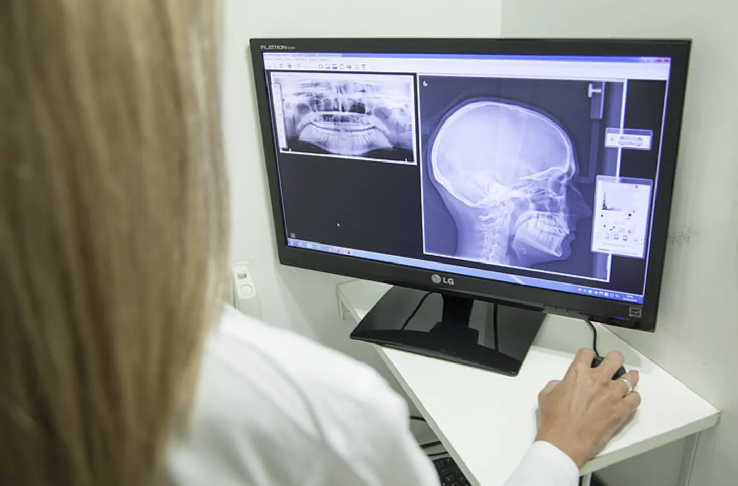 La Herramienta de IA Acelera el An&aacute;lisis de Im&aacute;genes M&eacute;dicas